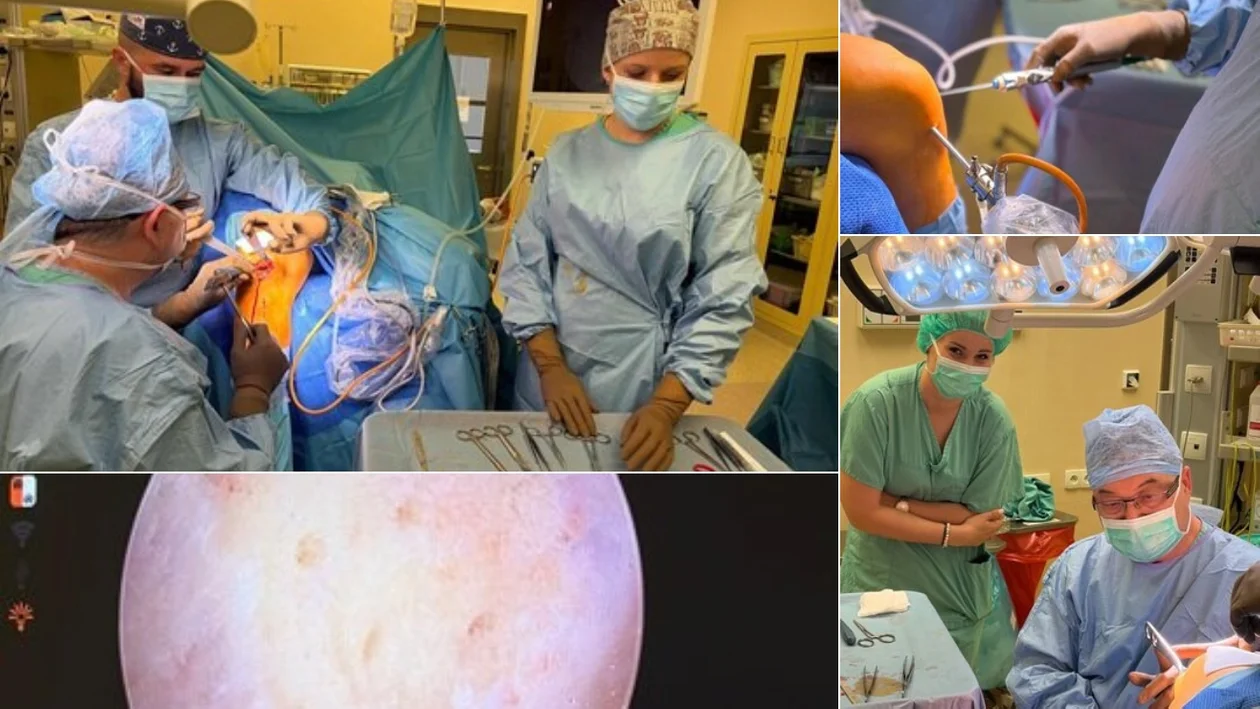 Przełom, który może zmienić życie pacjentów. Pierwszy taki zabieg w krotoszyńskim szpitalu