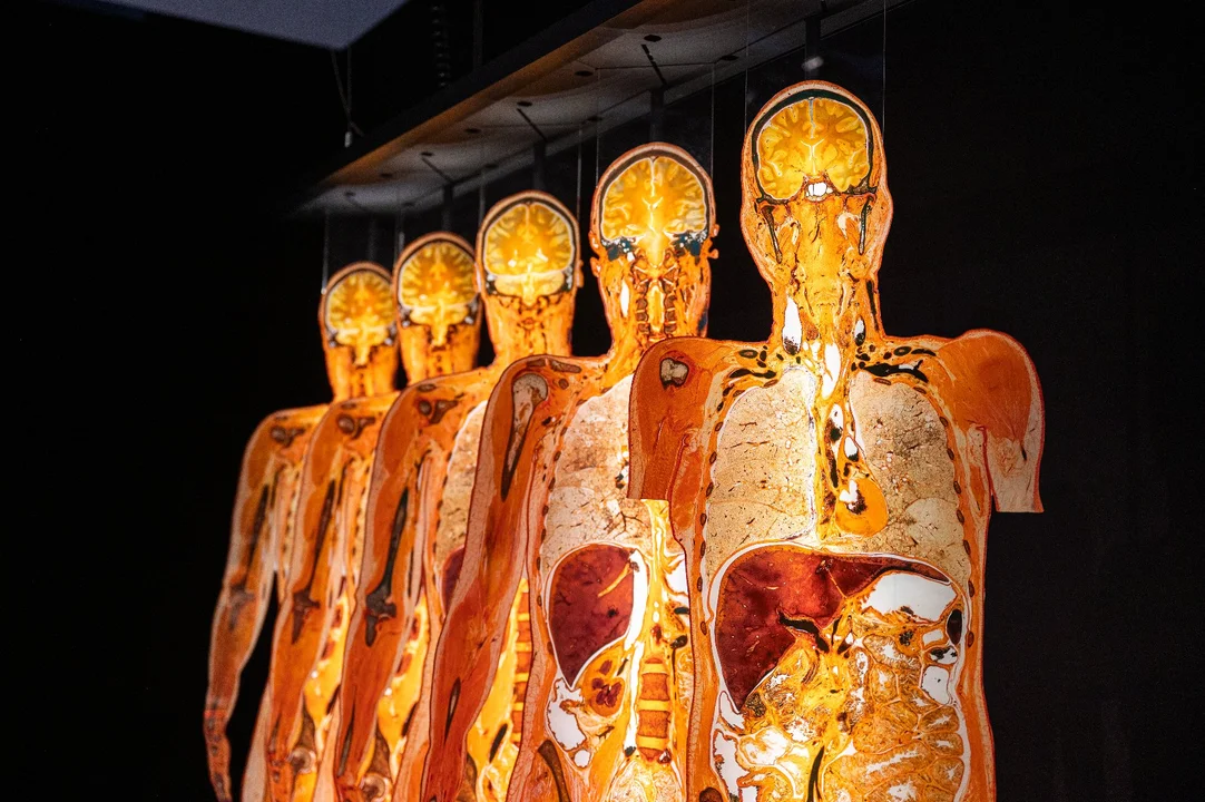 Wystawa Body Worlds powraca do Poznania