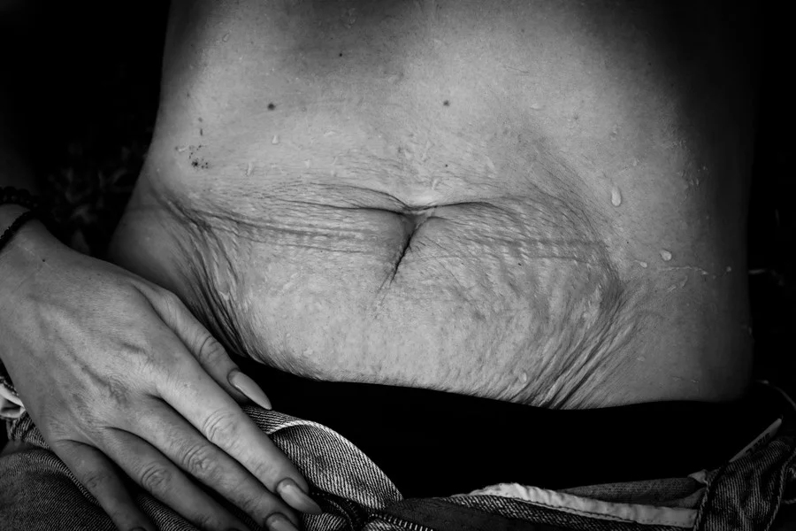 Po fali hejterskich komentarzy fotografka Laura Jagiołka ruszyła z niezwykłą akcją