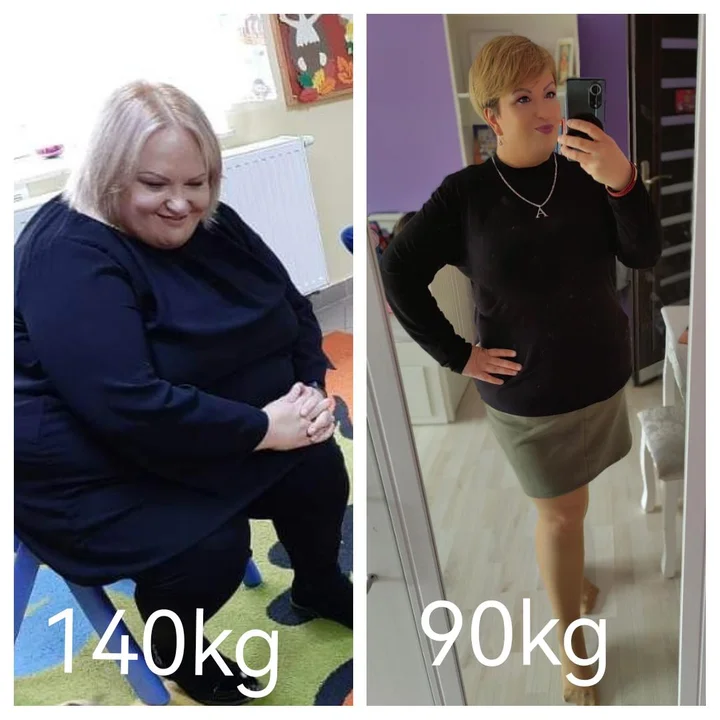 Patrząc na stare zdjęcia widzę nieszczęśliwą, spuchniętą chorą osobę — mówi Alicja, która schudła 50 kg