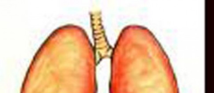 Zapisz się na bezpłatne badanie płuc - Zdjęcie główne