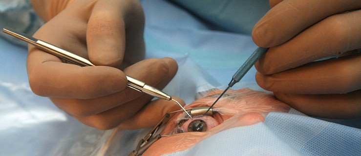 Jarocin stara się o dobrego okulistę, który będzie operował zaćmę - Zdjęcie główne