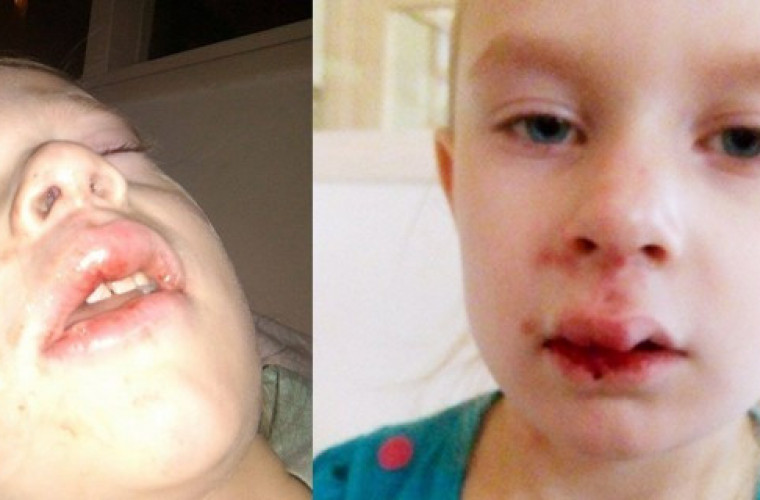 Krotoszyn. Lekarz zlekceważył obrażenia dziecka po wypadku - Zdjęcie główne