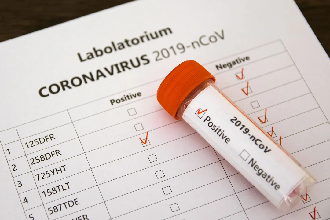 Chorzy na koronawirusa znów będą leczeni w Krotoszynie. Jak wyglądają statystyki zakażeń? - Zdjęcie główne