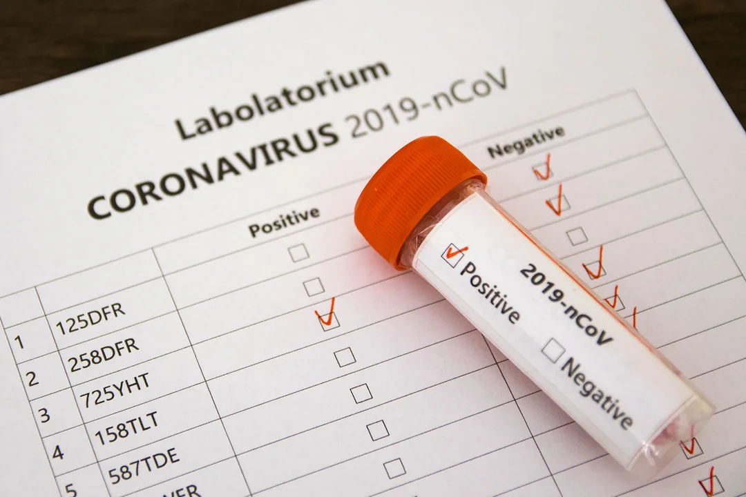 Koronawirus w powiecie krotoszyńskim. Najnowsze dane  - Zdjęcie główne