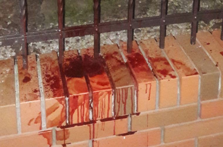 Mężczyzna z metalowym prętem w udzie trafił do szpitala - Zdjęcie główne