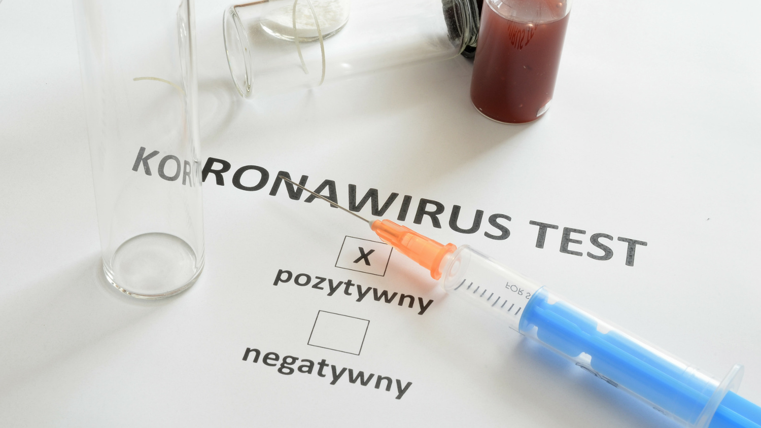 Koronawirus. Dziś w powiecie nie ma nowych zachorowań - Zdjęcie główne