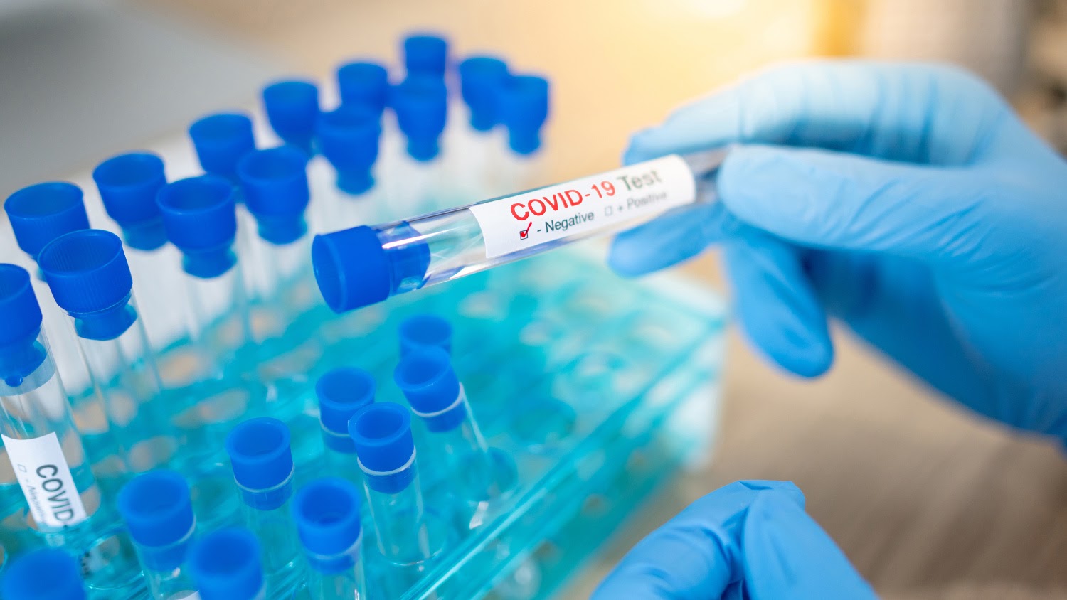 30 z 116 wykonanych testów okazało się pozytywnych - Zdjęcie główne