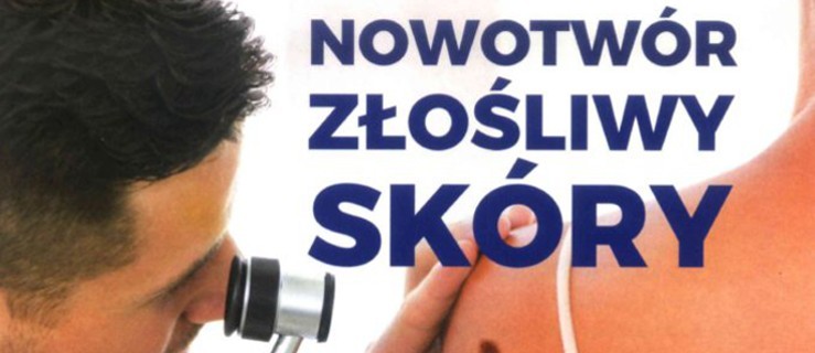 Zauważyłeś u siebie podejrzane znamiona? Zbadaj się za darmo - Zdjęcie główne