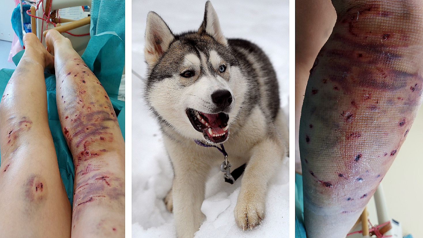 Dwa psy rasy husky zaatakowały kobietę. Gryzły ją przez 15 minut  - Zdjęcie główne